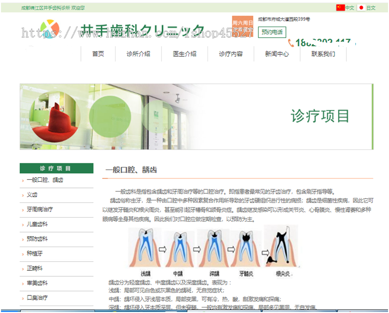 Thinkphp内核大气风格牙齿口腔牙科医院诊所网站源码PC+手机端