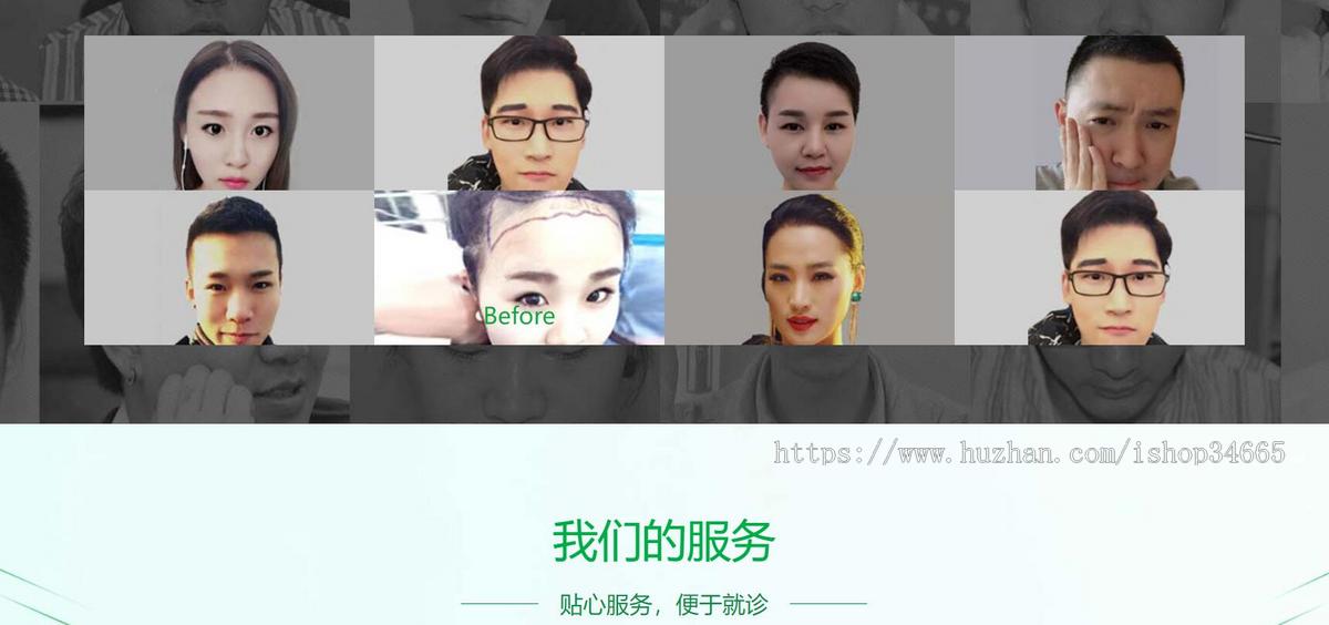 绿色的植发专科医院静态HTML网站模板